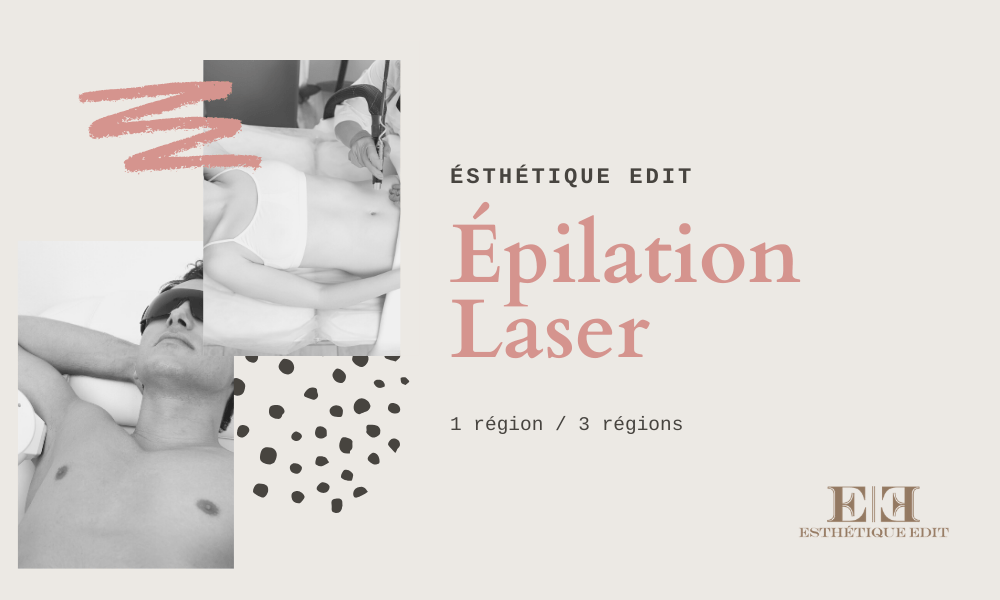 Image epilation laser