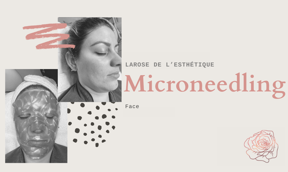 Microneedling facial care