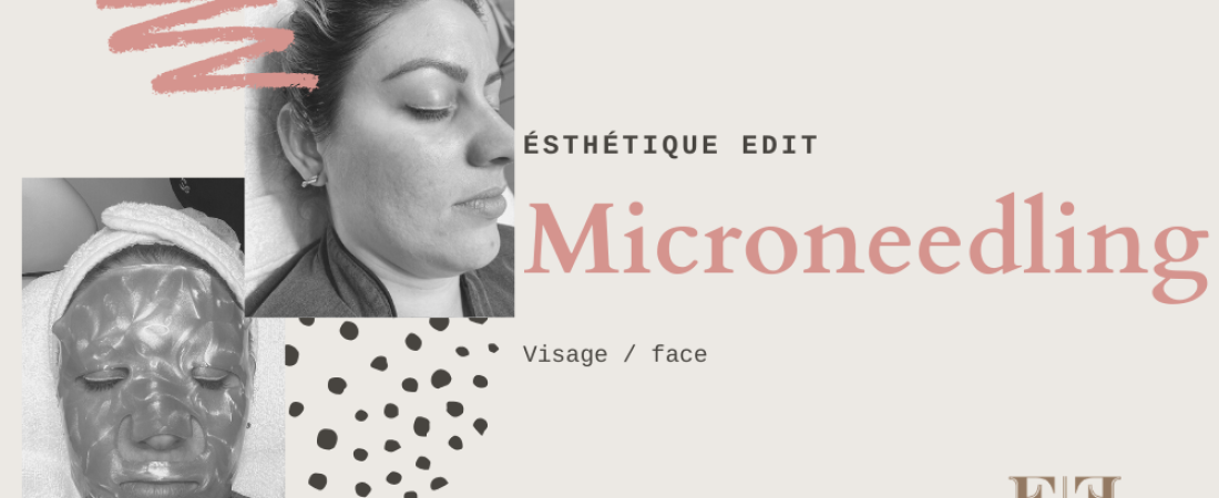 Mesotherapy and microneedling: what is it?